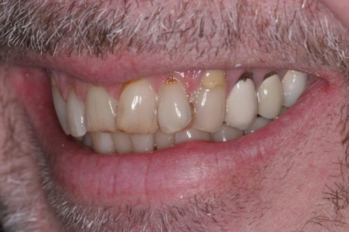 before dentistry at Leonard Hess, DDS, PA