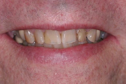 before dentistry at Leonard Hess, DDS, PA