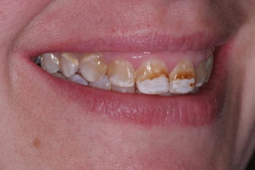 before dentistry at Leonard Hess, DDS, PA