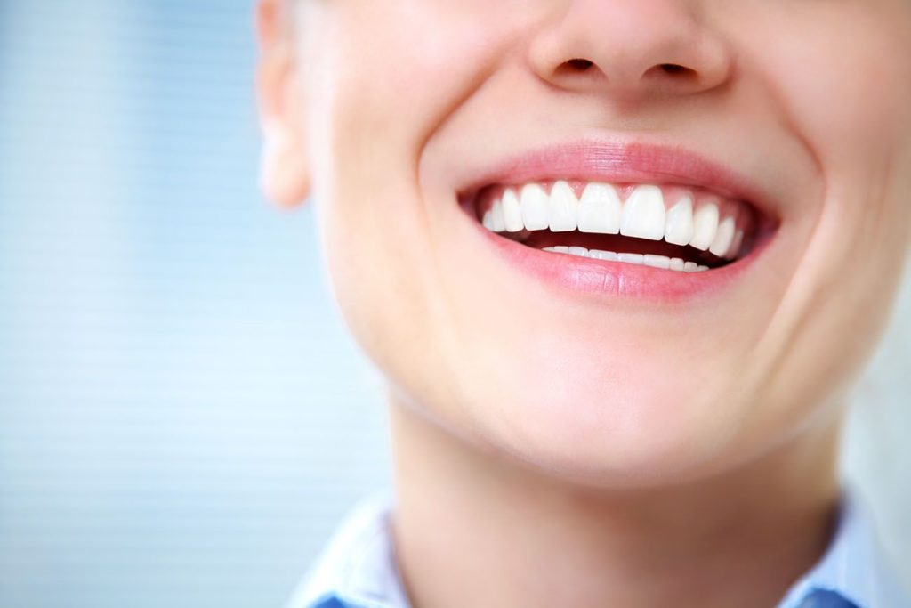 close-up of woman's straight white smile dental veneers dentist in Monroe North Carolina
