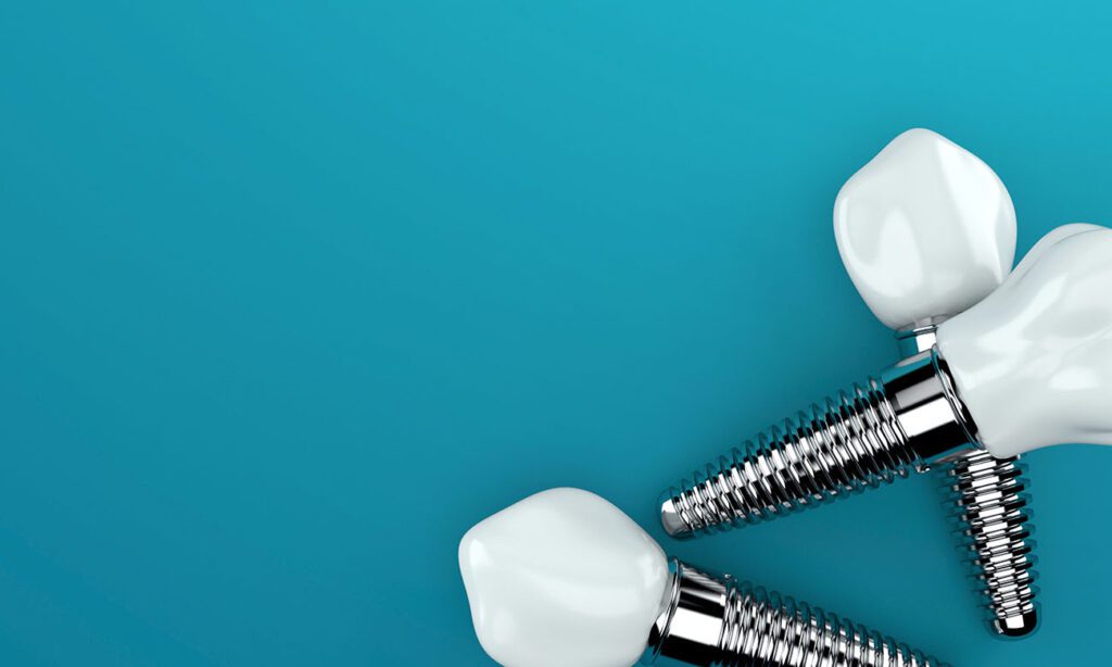 If you’re missing a tooth, a single dental implant in Monroe, NC, could help strengthen your bite and improve your oral health.