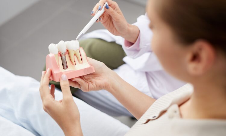 Understanding the various financing options can help make dental implants more attainable. Careful planning can alleviate financial concerns.