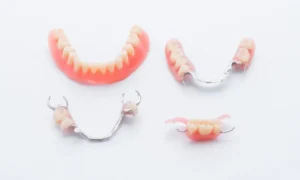 When You Don't Replace a Missing Tooth in Monroe, NC